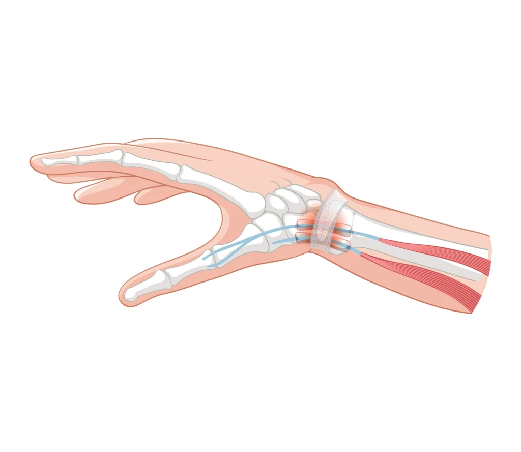 fracture trauma care specialist UAE